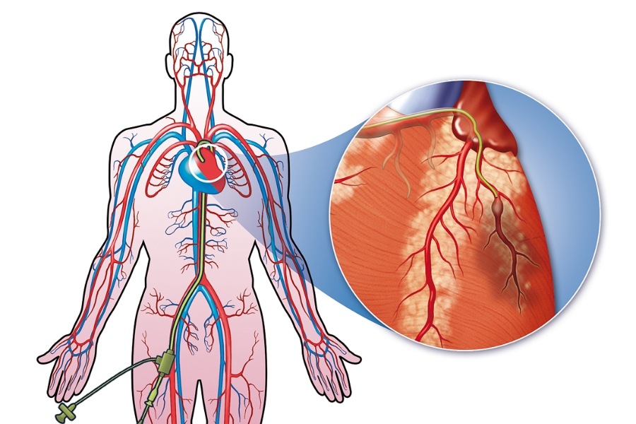 CardiacCatherization_590285272_12_21_2021.jpg